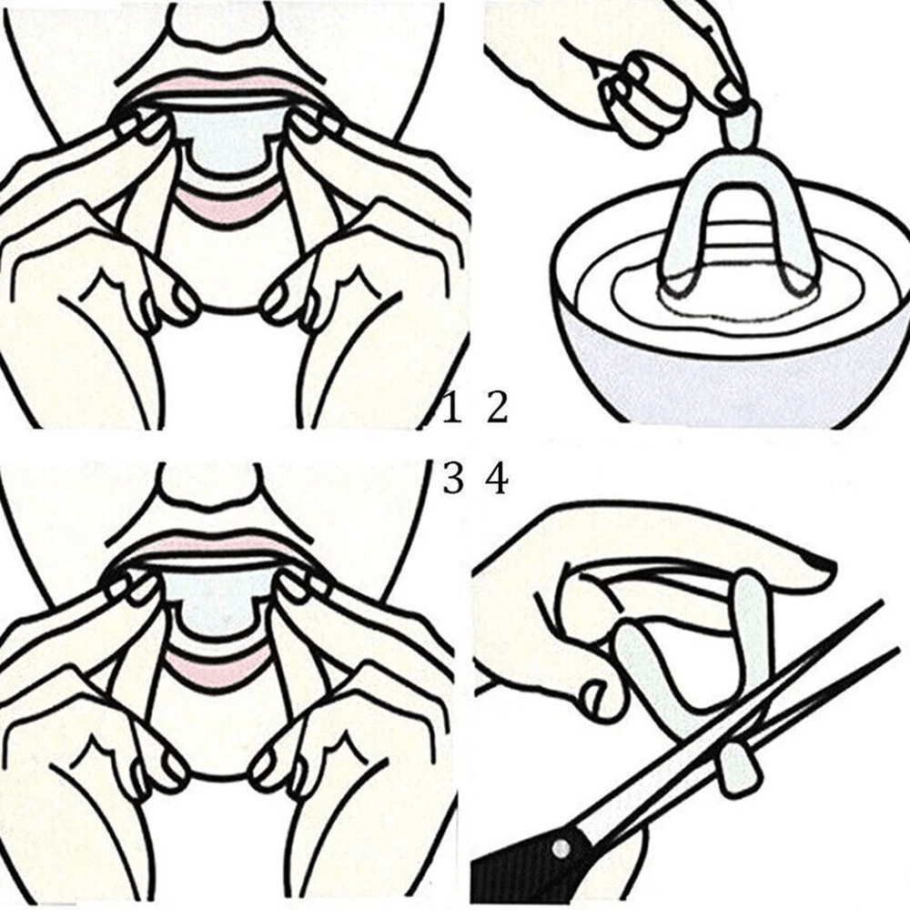 Silicone Mouth Guard For Night Sleep Dental Bite Tray For Teeth Grinding  Clenching 3
