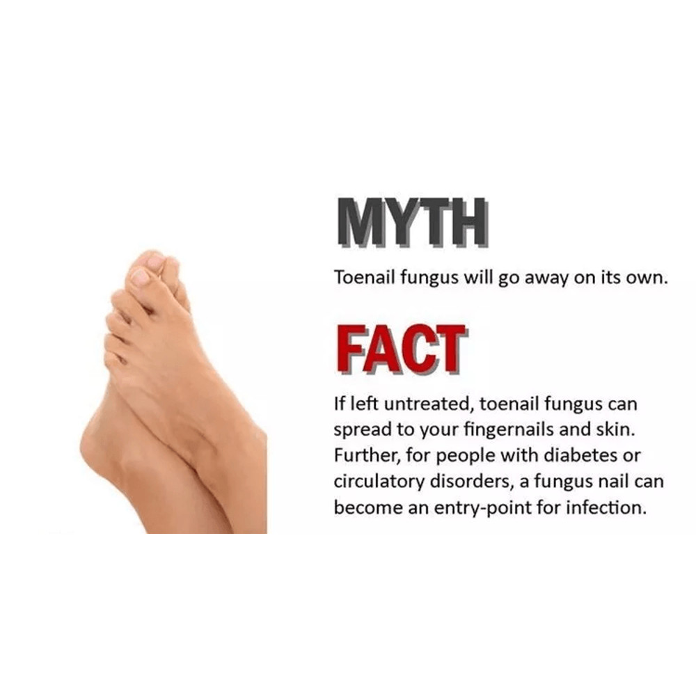 Natural Nail Fungus Treatment Effective Solution For Toe Finger Nail Infections 2