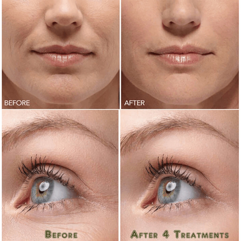 Hyaluronic Acid Gel Cream AntiAging Face Eye Moisturizer With NextGen HA Serum For Wrinkle Fine Lin 4