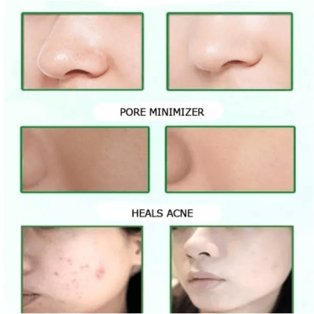 Dead Sea Mud Mask Acne Face Cleanser Blackhead Remover Healing Clay For Muscle Joint Pain Relief 1