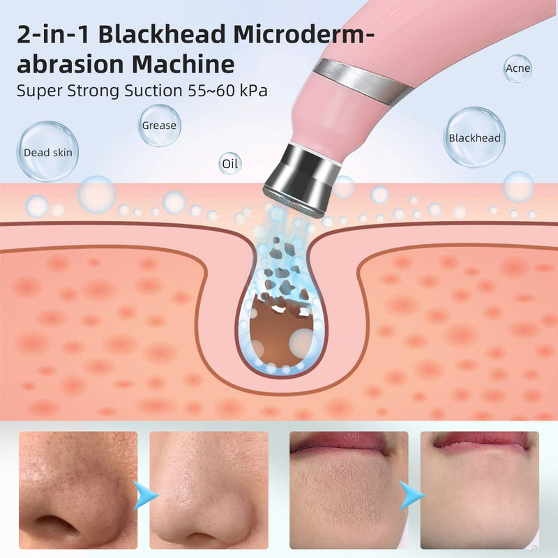Portable Diamond Peeling Machine, Microdermabrasion Facial Cleaning Device & Vacuum Blackhead Remover