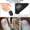 Nail Fungus Laser Device Super Pulsed Invisible Light Smart Remove and Repair Fungal Nail, Portable, Rechargeable