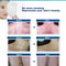 UV 311nm Ultraviolet Phototherapy Device Uses Philips Lamp UVB To Treat Vitiligo Psoriasis White Sp 3