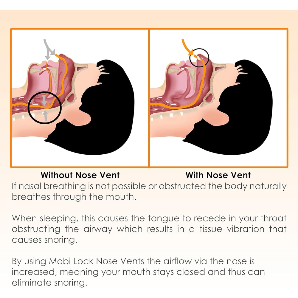 Anti Snore Nose Clip Set Comfortable Nasal Dilators For Snoring Sleep Apnea Relief 9