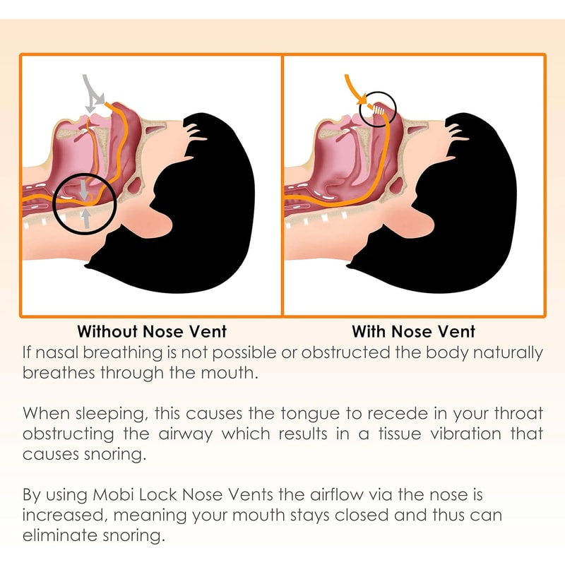 Anti Snore Nose Clip Set Comfortable Nasal Dilators For Snoring Sleep Apnea Relief 9