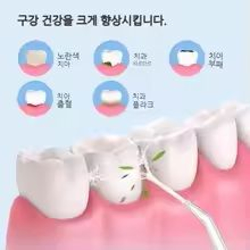 Advanced Water Flosser Oral Irrigator 360 Rotating Nozzle Intelligent Pressure Control 1