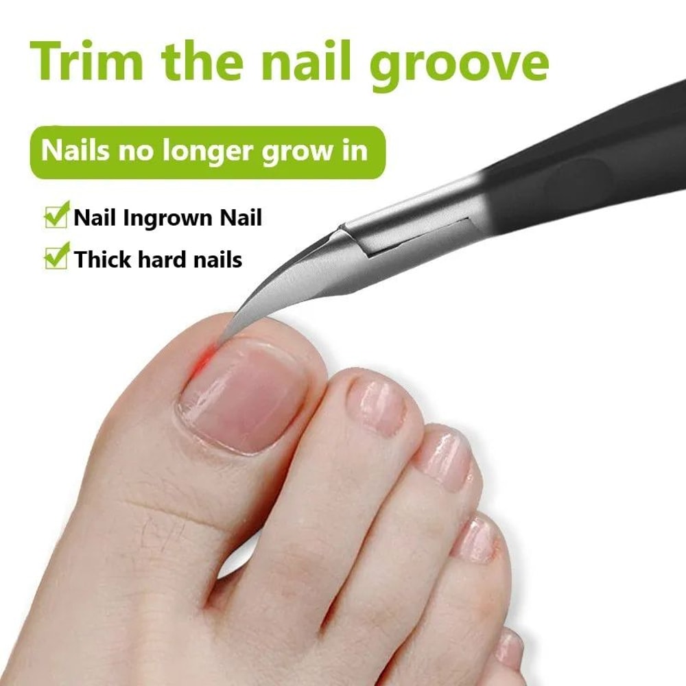 Professional Ingrown Toenail Clippers Paronychia Relief Stainless Steel Nail Nipper For Thick Toen 1