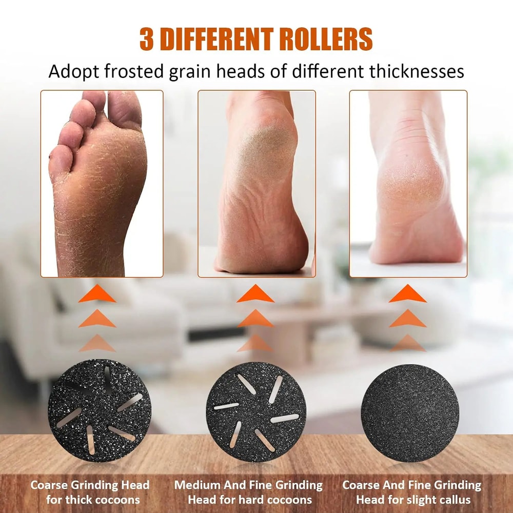 8 Pcs Callus Remover Roller Refills Replacement Foot File Heads For Hard Dead Skin Pedicure Foot C 5