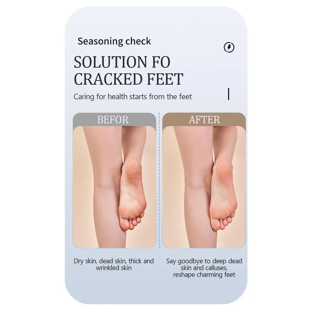 Waterproof Electric Foot Callus Remover USB Rechargeable Heel Grinder For Dead Skin Professional 6