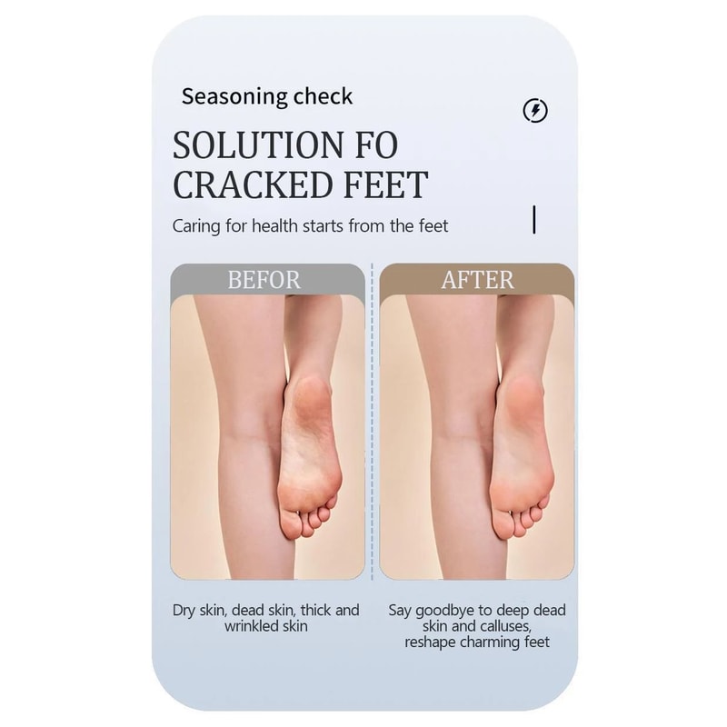Waterproof Electric Foot Callus Remover USB Rechargeable Heel Grinder For Dead Skin Professional 6