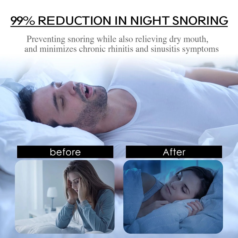Anti Snoring Mouth Tape Nose Breathing Correction Patch Improve Sleep Reduce Snoring Dry Mouth Nigh 2