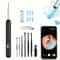 Wireless HD Visual Ear Cleaner With Camera USB Rechargeable Otoscope Wax Removal Tool 0