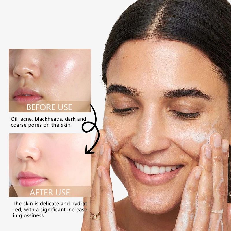 Rave Lady Low PH Gentle Facial Cleanser Oil Control Deep Cleansing Brightening Moisturizing Face