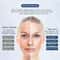 Ionic AntiWrinkle Face Massager Electronic Skin Tightening Whitening Beauty Device 2