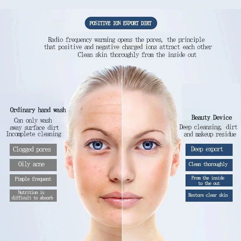 Ionic AntiWrinkle Face Massager Electronic Skin Tightening Whitening Beauty Device 2