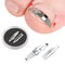 Professional Ingrown Toenail Corrector Tool Foot Care Pedicure Treatment 0