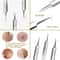 Professional UltraFine No5 Acne Blackhead Removal Tweezers Precision Pimple Extractor Tool 4