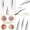 Professional UltraFine No5 Acne Blackhead Removal Tweezers Precision Pimple Extractor Tool 4