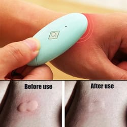 chemical free insect bite relief tool