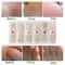 6 Pcs Foot Corn And Callus Protector Pads 2