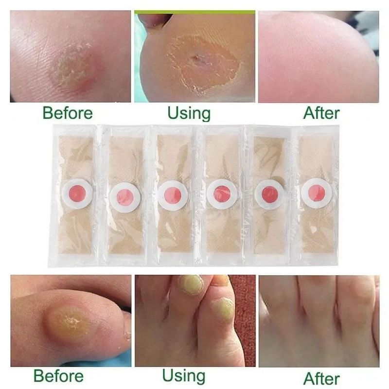 6 Pcs Foot Corn And Callus Protector Pads 2