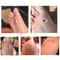 6 Pcs Foot Corn And Callus Protector Pads 4