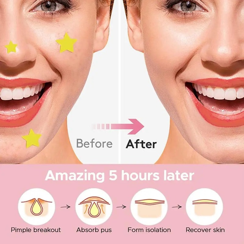 Star And Heart Acne Patch Stickers 12