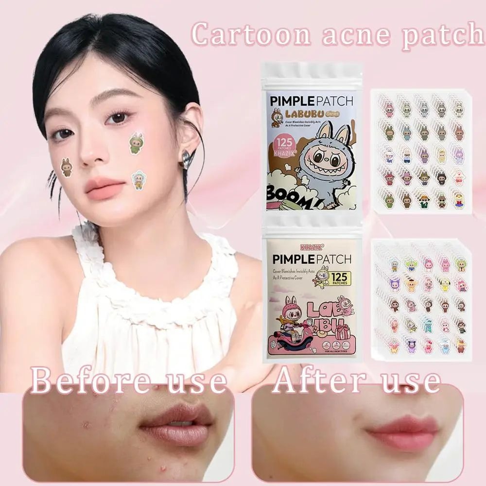 Cute Cartoon Acne Patch Stickers 250PCS 1