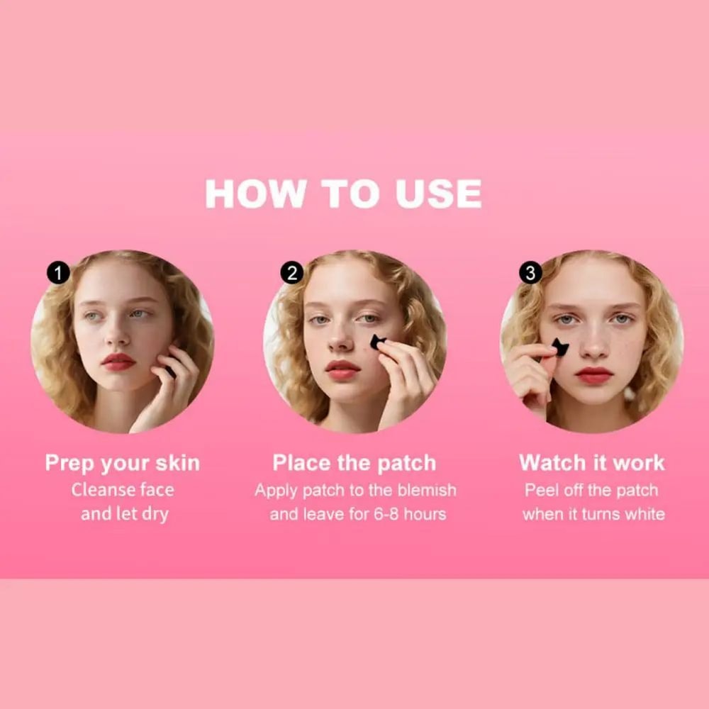 Cute Cartoon Acne Patch Stickers 250PCS 5