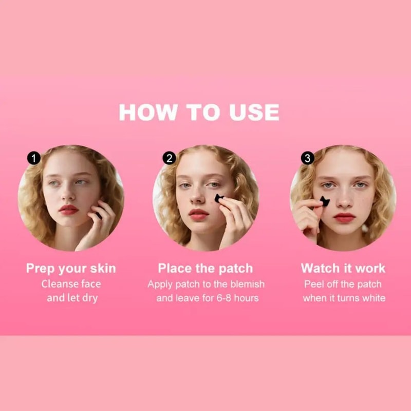 Cute Cartoon Acne Patch Stickers 250PCS 5