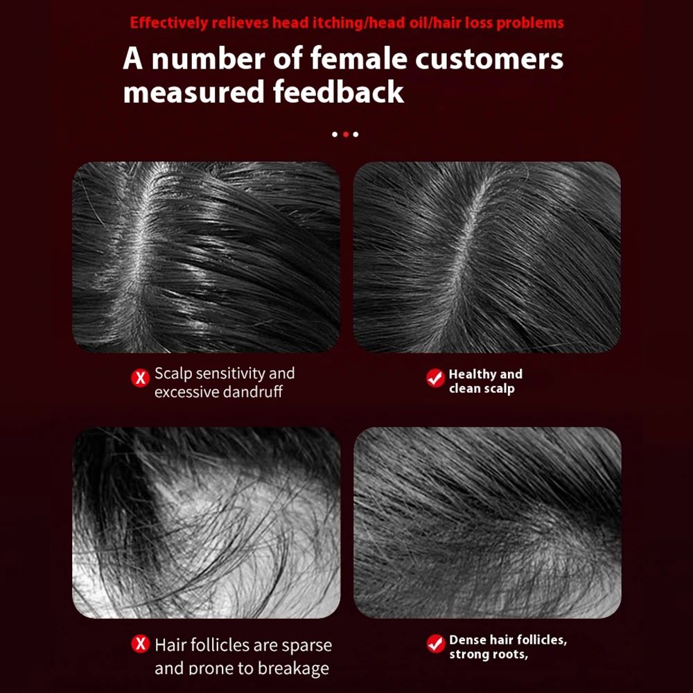 Electric Scalp Massage Comb With Red Light 10