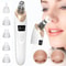 Electric Facial Blackhead Vacuum Cleaner 0