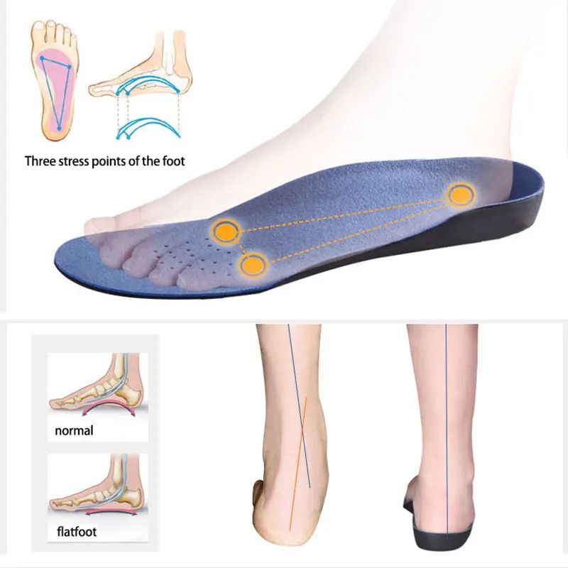 Arch Support Orthopedic Insoles 1
