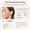 ANLAN MultiPolar RF EMS Facial Lifting Skin Tightening Device 2