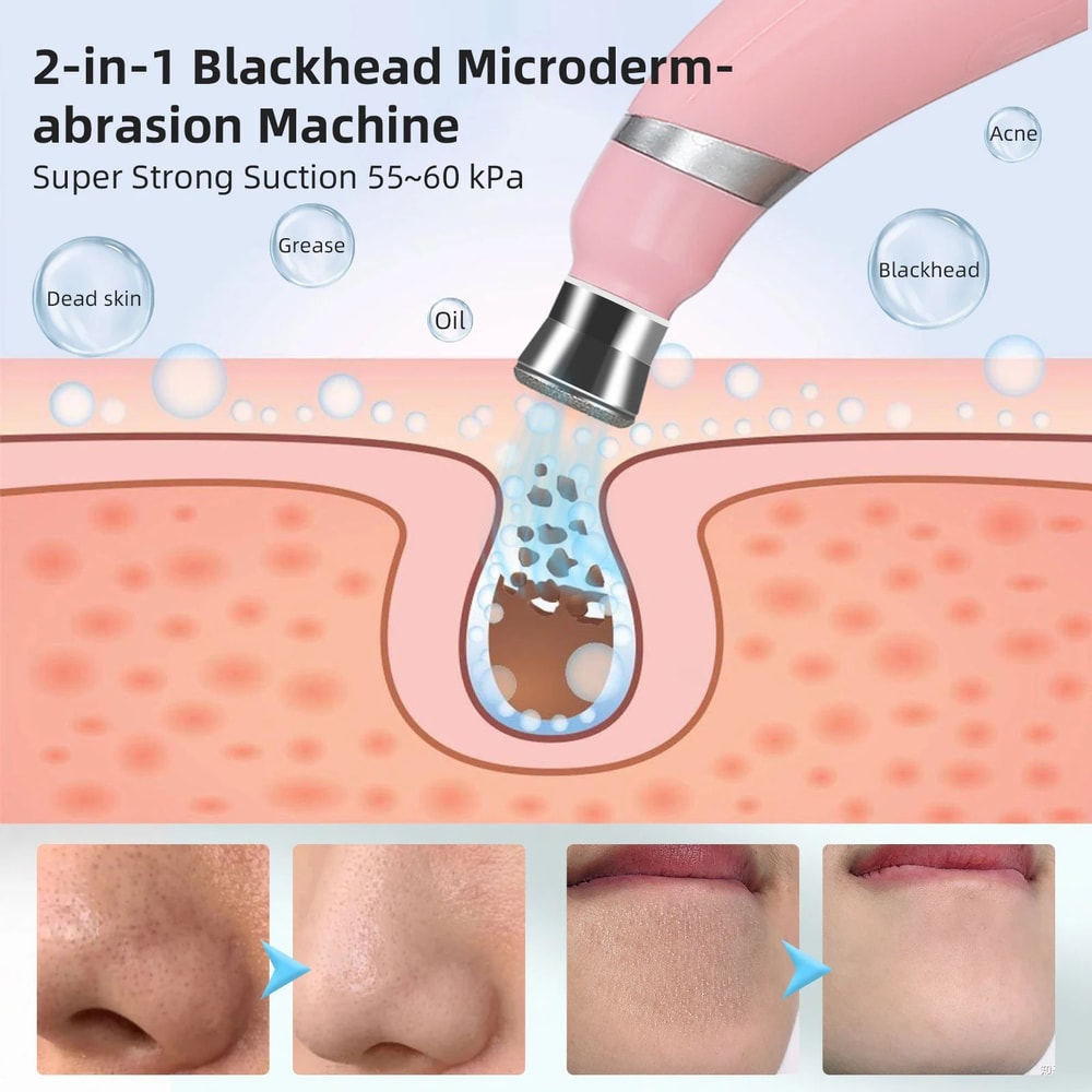 Professional Diamond Microdermabrasion Machine For Deep Facial Cleaning 18