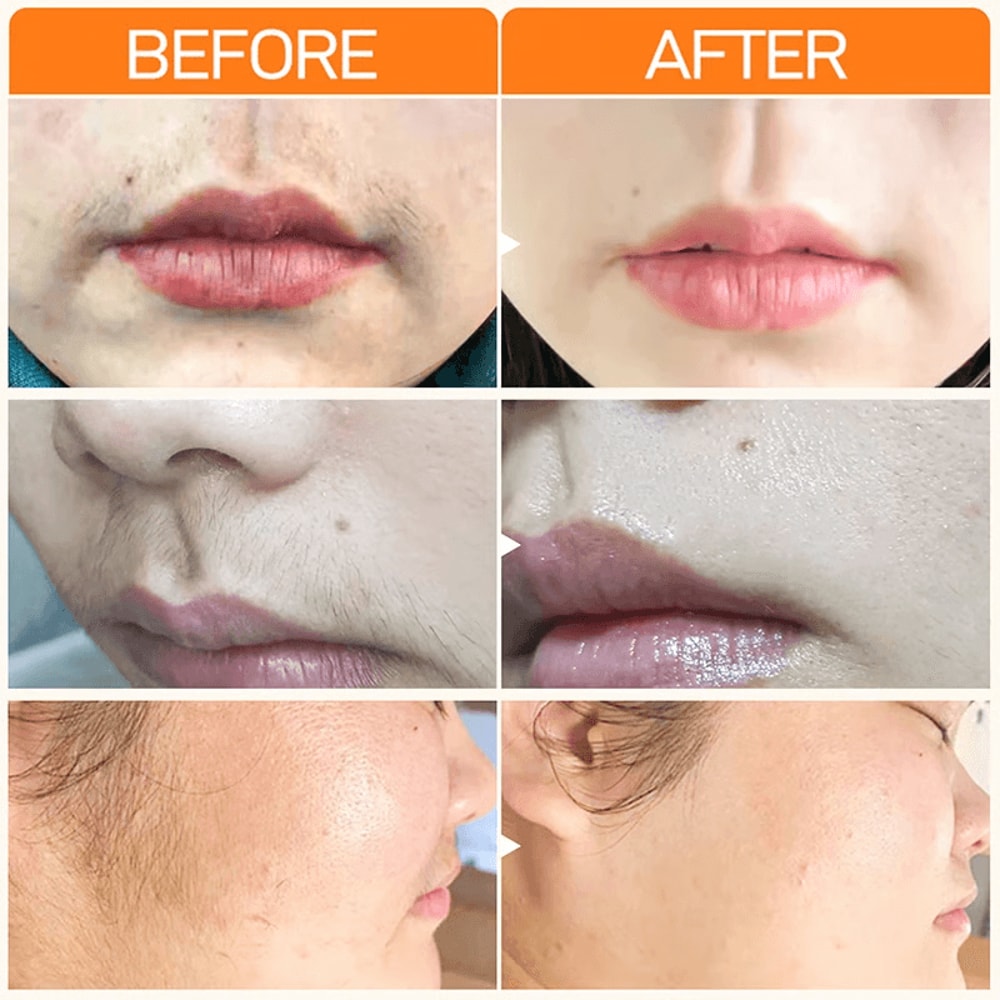 Fast Hair Removal Cream For Women Painless Whitening Skin Hydrating Formula 2