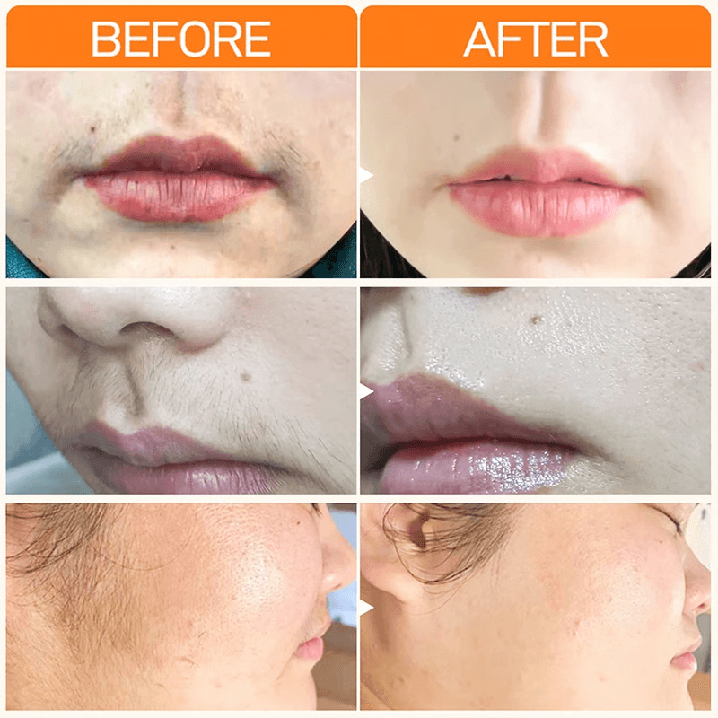 Fast Hair Removal Cream For Women Painless Whitening Skin Hydrating Formula 2