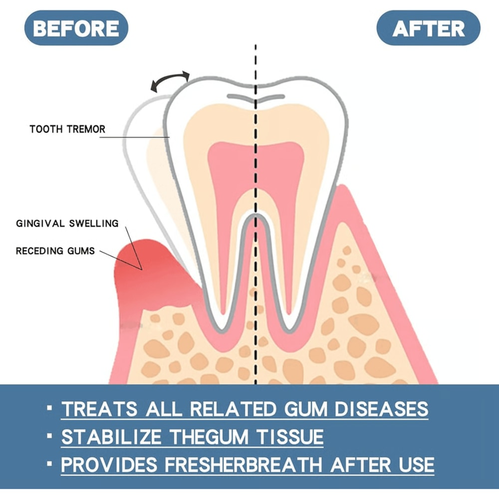 Rapid Repair Gum Serum For Sensitive Teeth And Gum Comfort Support 11