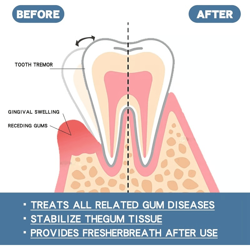 Rapid Repair Gum Serum For Sensitive Teeth And Gum Comfort Support 11