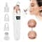 Blackhead Remover Vacuum Pore Cleaner Device 0
