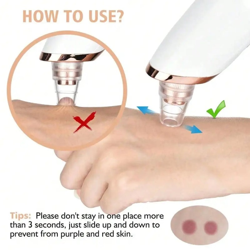 Blackhead Remover Vacuum Pore Cleaner Device 3