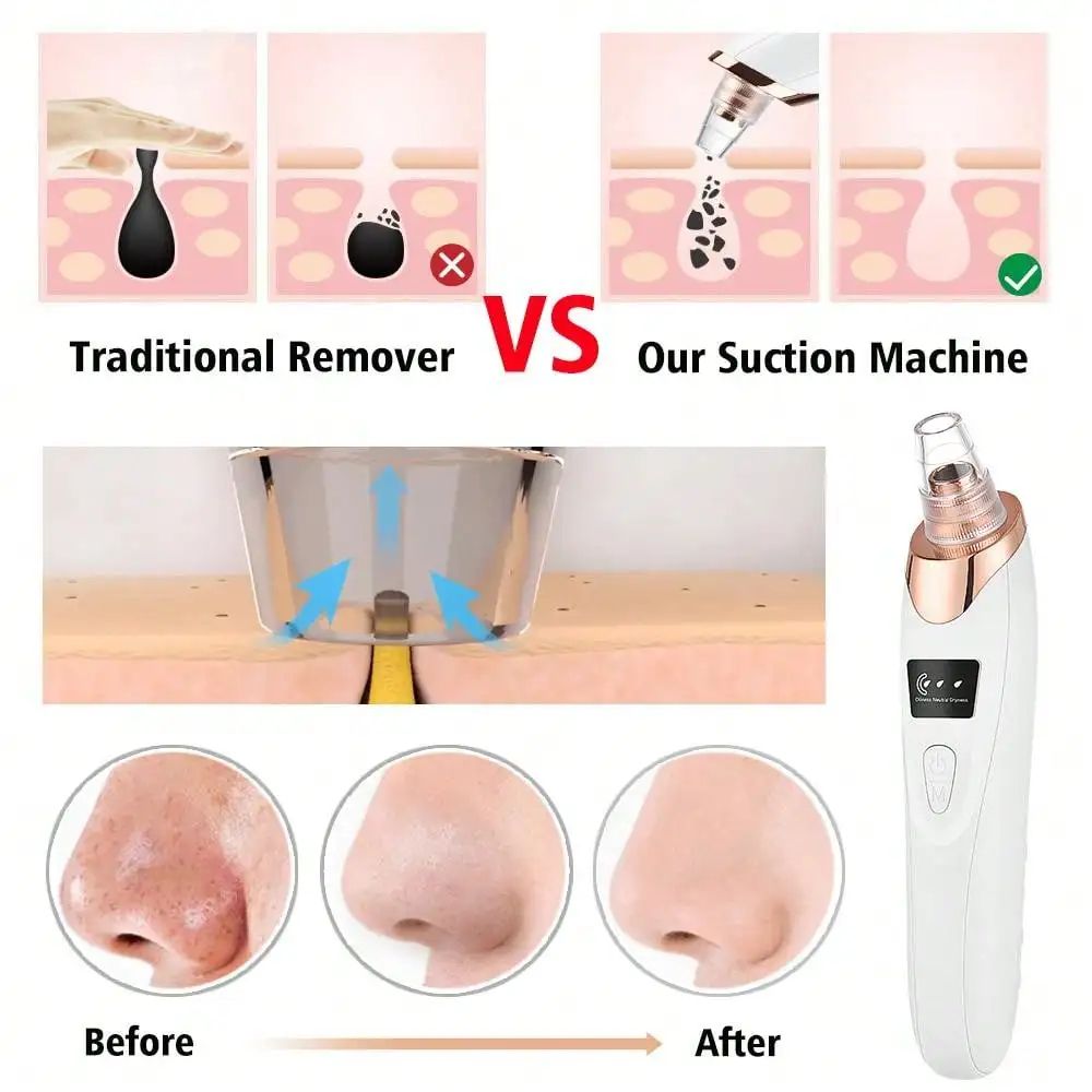 Blackhead Remover Vacuum Pore Cleaner Device 4