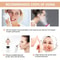 Blackhead Remover Vacuum Pore Cleaner Device 5