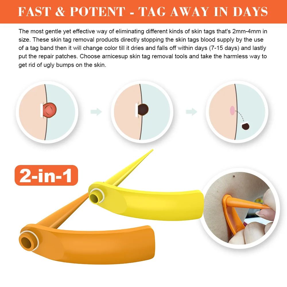 2 In 1 Electric Skin Tag Removal Pen Kit 2