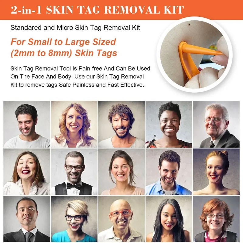 2 In 1 Electric Skin Tag Removal Pen Kit 3