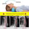 CerviEase Neck Shoulder Traction Relaxer For Deep Pain Relief And Cervical Spine Alignment 5