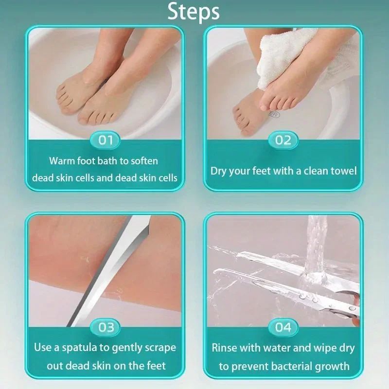 Professional Foot Callus Remover Pedicure Knife Kit For Smooth Heels 5