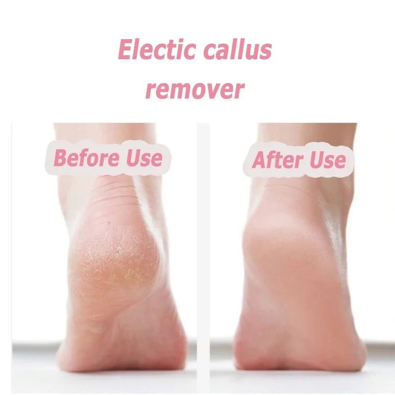 Rechargeable Electric Foot File Callus Remover For Smooth Heels USB Pedicure Tool For Men Women 2