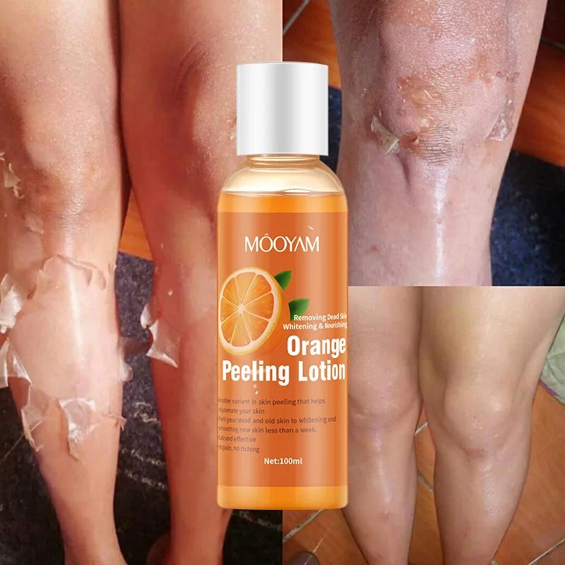 100ml Orange Peeling Oil Moisturizing Foot Exfoliator For Rough Elbows Knees Heels 1