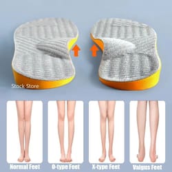 arch support insoles for flat feet – orthopedic valgus correction shoe inserts